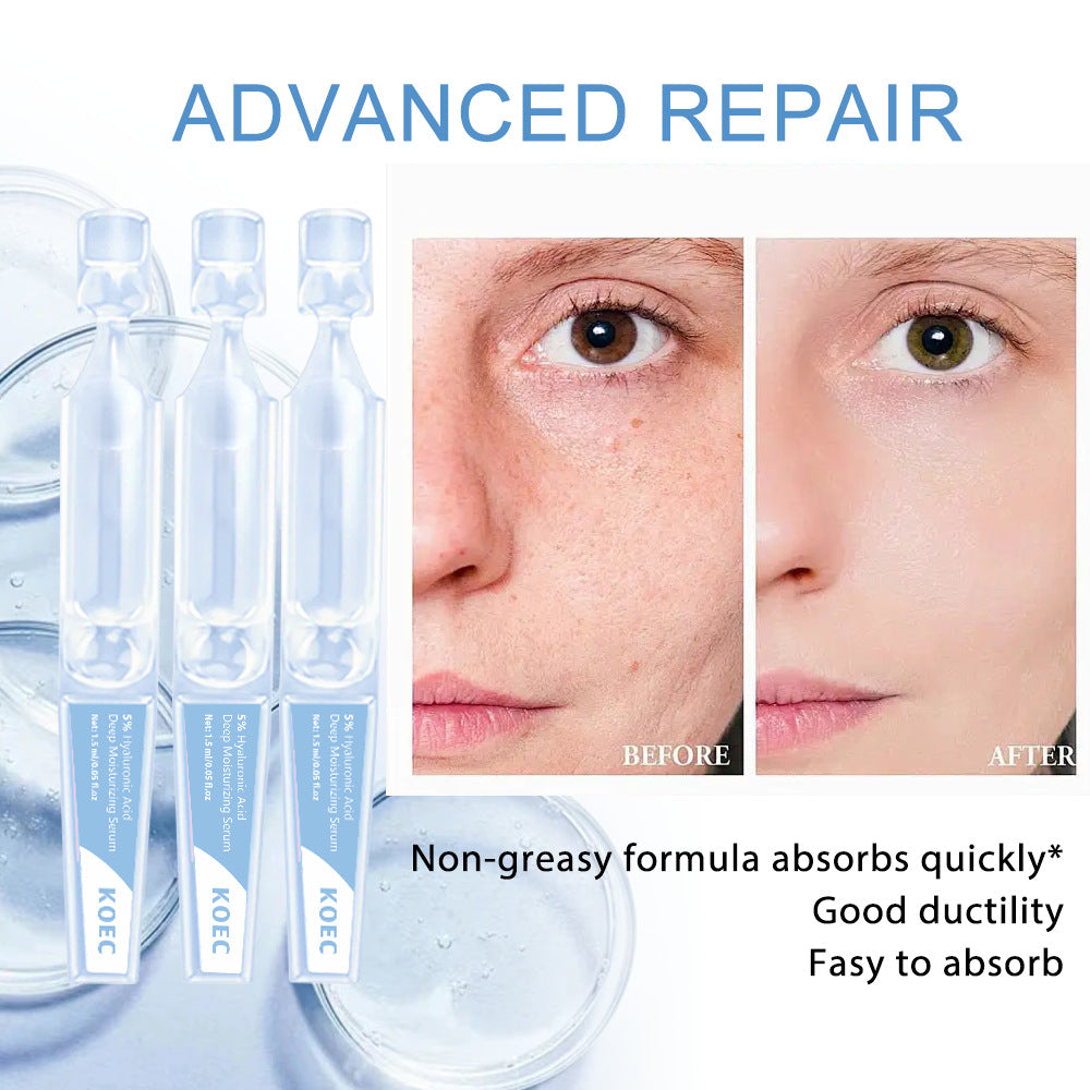 This Is How Thousands of Women Are Getting Rid of Their Wrinkles ✨