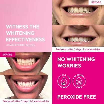 Teeth Whitening Strips 14 Treatments Kit, Peroxide Free Gentle Enamel Safe Green Strips, Instant Teeth Brightener w/ Coconut Oil
